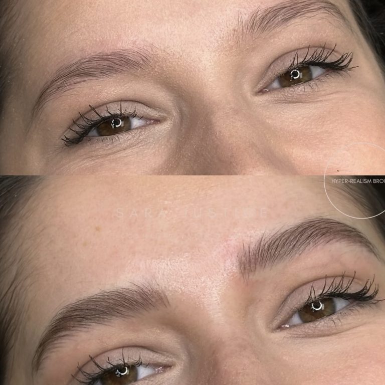 before and after Hyper-Realism Brows treatment