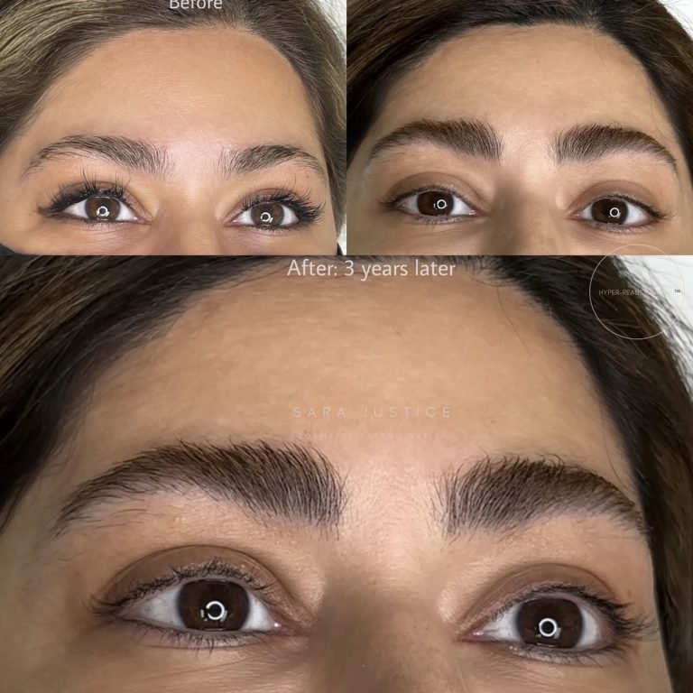 photo before and 3 years after Hyper-Realism Brows treatment