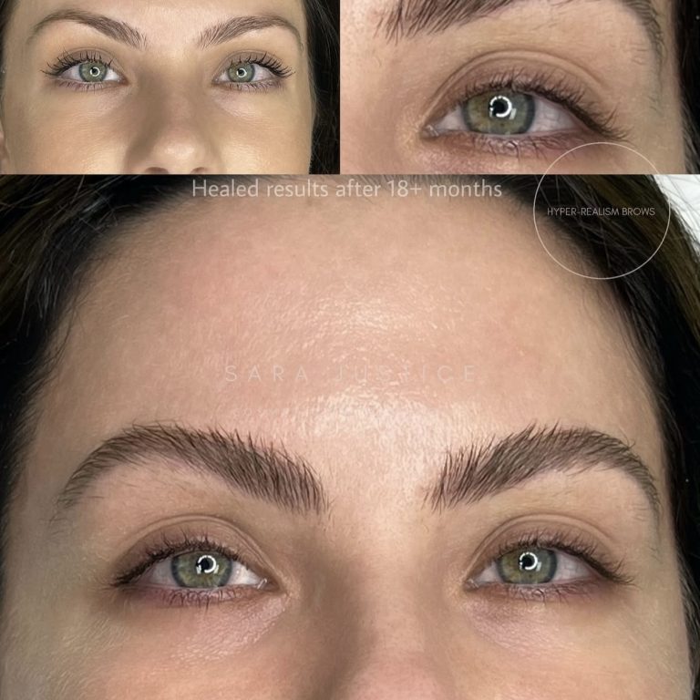 photo before and 18+ months after Hyper-Realism Brows treatment